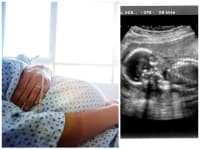 Tehotná žena (32) balansovala na hranici života a smrti: Lekári nemali na výber, jej syn sa narodil dvakrát!