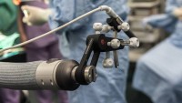Raritní operace v Brně: Ušní implantát zavádí unikátní robotické rameno