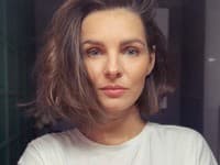 Pfuuu! Monika Szabó po 3 mesiacoch od NEHODY ukázala JAZVU: Toto nie je pre SLABÉ povahy