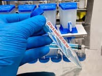 V bazénových vodách budú mimoriadne odbery na prítomnosť améb, potvrdila hlavná hygienička