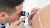 Odvykání kouření, psycholog i kryokomora. I na to pojišťovny přispívají dospělým