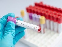 Zásadný prelom v zdravotníctve! V USA schválili injekciu na prevenciu proti vírusu HIV: Dosiahla skvelé výsledky