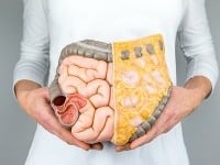 Mladých kosí rakovina hrubého čreva: Vedci odhalili 5 desivých dôvodov, prečo stúpa počet prípadov