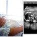 Tehotná žena (32) balansovala na hranici života a smrti: Lekári nemali na výber, jej syn sa narodil dvakrát!