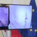 VIDEO: Kaliňák a Gašpar sa obávajú ďalšieho útoku, na výstrahu ukázali Ficovo brucho po atentáte