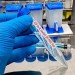 V bazénových vodách budú mimoriadne odbery na prítomnosť améb, potvrdila hlavná hygienička