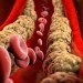Trápi vás vysoký cholesterol a bolesti kĺbov? TENTO domáci sirup to zmení