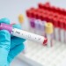 Zásadný prelom v zdravotníctve! V USA schválili injekciu na prevenciu proti vírusu HIV: Dosiahla skvelé výsledky