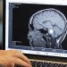 Contributor: The human brain doesn't learn, think or recall like an AI. Embrace the difference